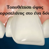 Νικόλαος Καραπάνος οδοντιατρική nkarapanos.gr