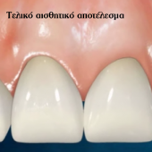 Νικόλαος Καραπάνος οδοντιατρική nkarapanos.gr