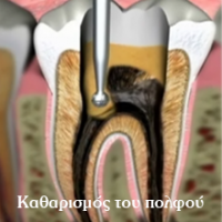 Νικόλαος Καραπάνος οδοντιατρική nkarapanos.gr