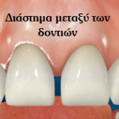 Νικόλαος Καραπάνος οδοντιατρική nkarapanos.gr
