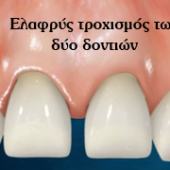 Νικόλαος Καραπάνος οδοντιατρική nkarapanos.gr